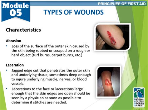 Coding Different Types of Wounds – A Detailed Overview